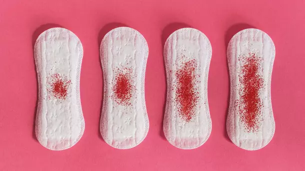 Possible causes of vaginal spotting (bleeding) between periods